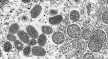 Varíola dos macacos: OMS declara emergência internacional de saúde
