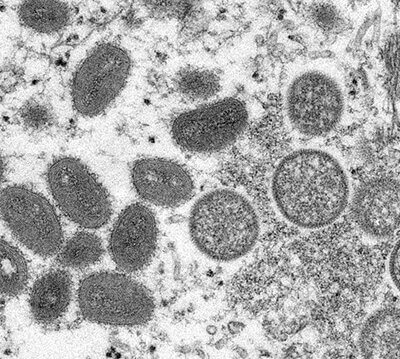 Caso de varíola dos macacos em Indaiatuba foi confirmado pelo Instituto Adolfo Lutz (Imagem: Cynthia Goldsmith)