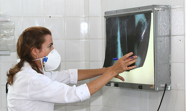 Campanha de Busca Ativa de Casos de Tuberculose acontece neste mês em Indaiatuba (Foto: Carol Garcia/Agecom/Bahia)