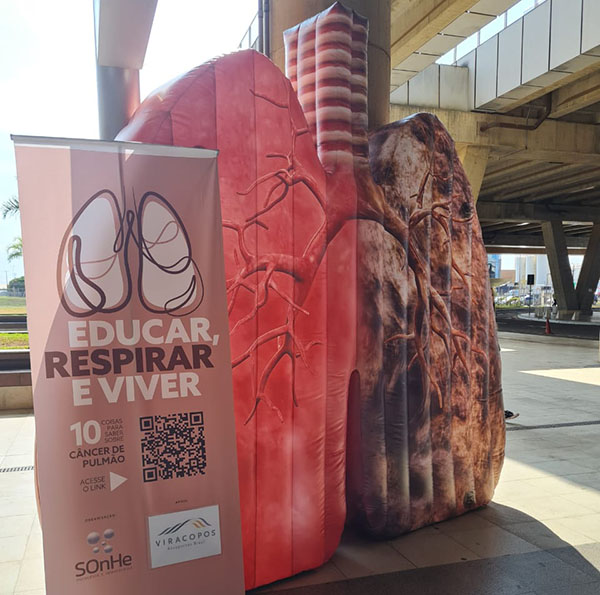 Pulmão gigante visita Viracopos e Indaiatuba neste mês de agosto (Foto: Divulgação)