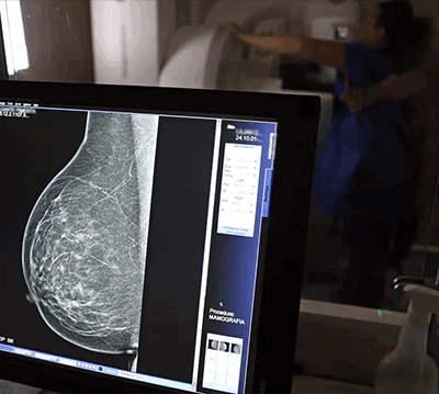 Ministério da Saúde passa a recomendar mamografia a partir dos 40 anos (Foto: José Cruz/Agência Brasil)